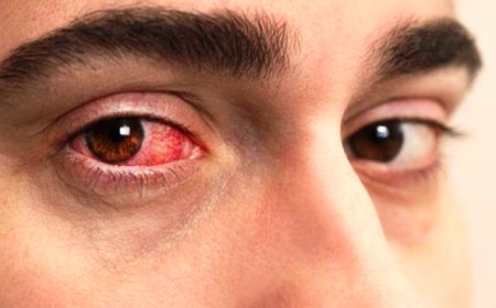 Study links weight-loss drugs to serious eye problems
